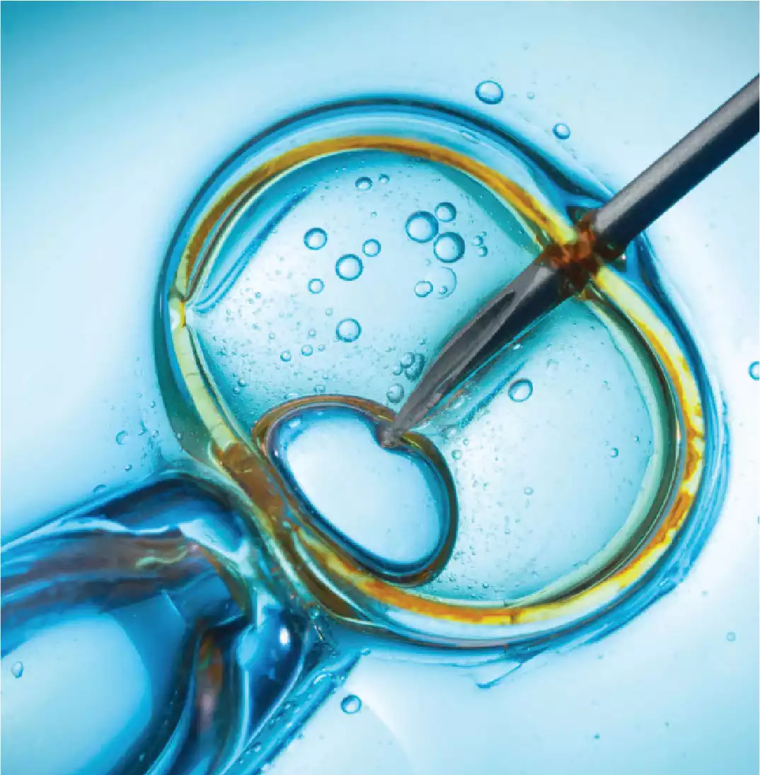 In Vitro Fertilization Centers | KSA